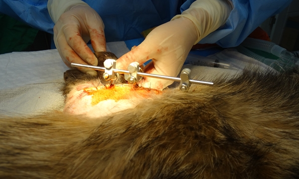 김희종4월_7_너구리상완골고정술