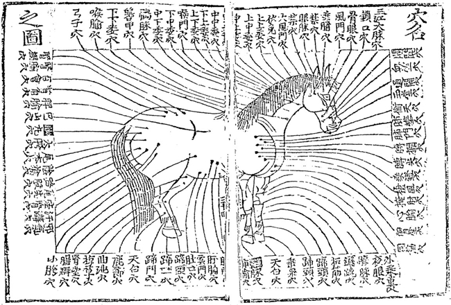 신편집성마의방_혈명지도