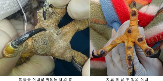 140915 김희종 매5