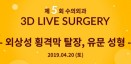 `외상성 횡격막 탈장，유문성형` 3D 라이브 서저리 교육 4월 20일 개최