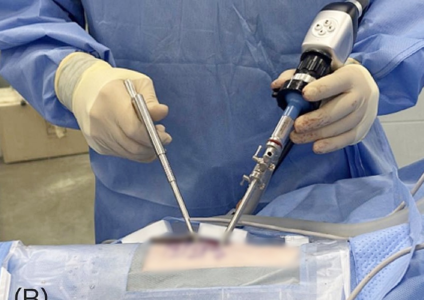 13마리 반려견 디스크 환자 척추내시경 수술했더니..합병증 없이 잘 회복