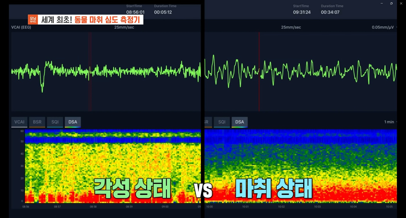 이 이미지는 대체 속성이 비어있습니다. 그 파일 이름은 20251201brainU_vetCAI2.jpg입니다