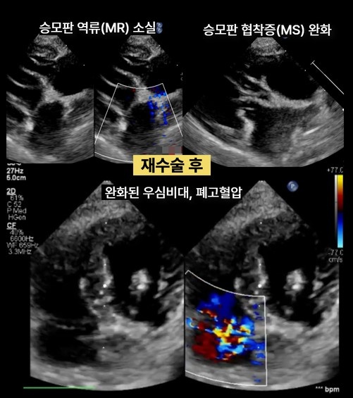 반려견 개심술 50례 분석해 보니..넬동물의료센터 “생존퇴원율 98%, 수술 후 단약율 100%”
